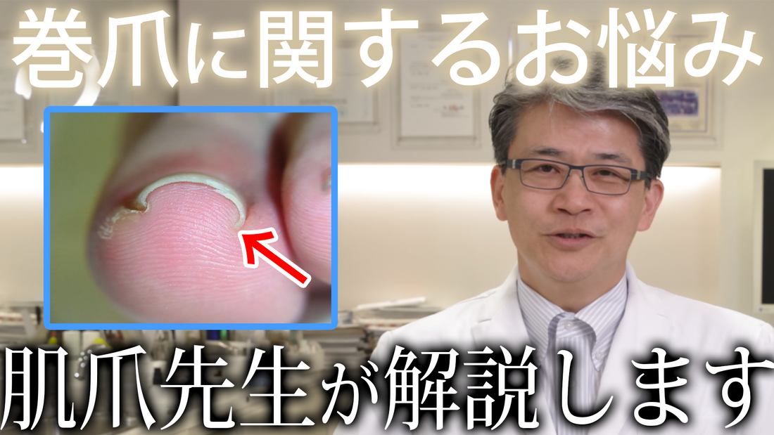 オニックスワイヤー®を使った巻き爪矯正の施術動画をYoutubeに公開しました